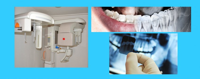 Dental radyoloji ve görüntüleme