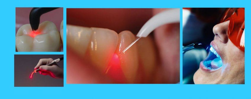 Diş hekimliğinde laser